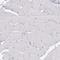 Calmegin antibody, NBP2-49288, Novus Biologicals, Immunohistochemistry paraffin image 