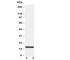 Superoxide Dismutase 1 antibody, R30411, NSJ Bioreagents, Western Blot image 