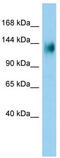 Pleckstrin Homology And RhoGEF Domain Containing G3 antibody, TA331945, Origene, Western Blot image 