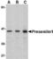 Presenilin 1 antibody, MBS151535, MyBioSource, Western Blot image 