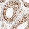 General Transcription Factor IIE Subunit 2 antibody, NBP1-87931, Novus Biologicals, Immunohistochemistry frozen image 