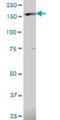 Eukaryotic Translation Initiation Factor 5B antibody, H00009669-B01P, Novus Biologicals, Western Blot image 