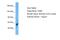 T Cell Lymphoma Invasion And Metastasis 2 antibody, PA5-71385, Invitrogen Antibodies, Western Blot image 