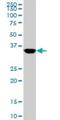 Mesenchyme Homeobox 2 antibody, H00004223-M02, Novus Biologicals, Western Blot image 