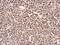 6-Phosphofructo-2-Kinase/Fructose-2,6-Biphosphatase 3 antibody, PA5-21931, Invitrogen Antibodies, Immunohistochemistry frozen image 