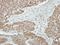 Zinc Finger And BTB Domain Containing 9 antibody, LS-C155488, Lifespan Biosciences, Immunohistochemistry frozen image 