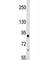 Integrin Subunit Beta 2 antibody, F46195-0.4ML, NSJ Bioreagents, Western Blot image 