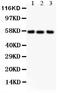 Alkaline Phosphatase, Biomineralization Associated antibody, LS-C344094, Lifespan Biosciences, Western Blot image 