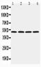 Hyaluronidase 1 antibody, GTX12396, GeneTex, Western Blot image 