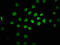 Cullin Associated And Neddylation Dissociated 1 antibody, CSB-PA774815LA01HU, Cusabio, Immunofluorescence image 