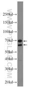 Lactase Like antibody, 24589-1-AP, Proteintech Group, Western Blot image 