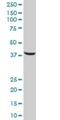 Serine And Arginine Rich Splicing Factor 5 antibody, H00006430-B01P, Novus Biologicals, Western Blot image 