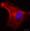 Clathrin Heavy Chain antibody, ab2731, Abcam, Immunofluorescence image 