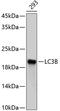 Microtubule Associated Protein 1 Light Chain 3 Beta antibody, 14-194, ProSci, Western Blot image 