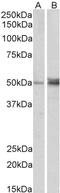 Forkhead Box L2 antibody, 45-617, ProSci, Enzyme Linked Immunosorbent Assay image 