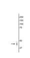 Gamma-Aminobutyric Acid Type A Receptor Gamma2 Subunit antibody, NB300-190, Novus Biologicals, Western Blot image 