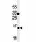 S100 Calcium Binding Protein A1 antibody, F41686-0.4ML, NSJ Bioreagents, Western Blot image 
