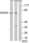 Death Domain Associated Protein antibody, LS-C119542, Lifespan Biosciences, Western Blot image 