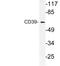 Ectonucleoside Triphosphate Diphosphohydrolase 1 antibody, LS-C177832, Lifespan Biosciences, Western Blot image 