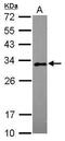 RAB20, Member RAS Oncogene Family antibody, PA5-31500, Invitrogen Antibodies, Western Blot image 