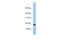 C1D Nuclear Receptor Corepressor antibody, 30-629, ProSci, Western Blot image 