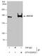 Rho Associated Coiled-Coil Containing Protein Kinase 2 antibody, GTX122652, GeneTex, Immunoprecipitation image 