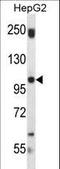 Staphylococcal Nuclease And Tudor Domain Containing 1 antibody, LS-C161343, Lifespan Biosciences, Western Blot image 