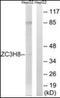 Zinc Finger CCCH-Type Containing 8 antibody, orb96622, Biorbyt, Western Blot image 