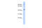 Zinc Finger Protein X-Linked antibody, 25-143, ProSci, Enzyme Linked Immunosorbent Assay image 