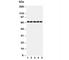 Nuclear Factor, Erythroid 2 Like 2 antibody, R30926, NSJ Bioreagents, Western Blot image 