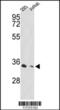 Proteasome 26S Subunit, Non-ATPase 11 antibody, MBS9207084, MyBioSource, Western Blot image 