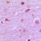 NEDD4 Binding Protein 1 antibody, LS-C353189, Lifespan Biosciences, Immunohistochemistry frozen image 