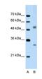 Interferon Regulatory Factor 6 antibody, orb330320, Biorbyt, Western Blot image 