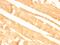 Glypican 3 antibody, NBP2-48398, Novus Biologicals, Immunohistochemistry paraffin image 