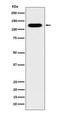 Cadherin 16 antibody, M07518-1, Boster Biological Technology, Western Blot image 