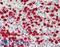 Hepatocyte Growth Factor-Regulated Tyrosine Kinase Substrate antibody, LS-B12780, Lifespan Biosciences, Immunohistochemistry paraffin image 
