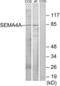 Semaphorin 4A antibody, LS-C119263, Lifespan Biosciences, Western Blot image 