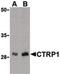 C1q And TNF Related 1 antibody, PA5-20146, Invitrogen Antibodies, Western Blot image 