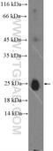 Immunoglobulin Lambda Constant 1 antibody, 20758-1-AP, Proteintech Group, Western Blot image 