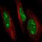 Ubiquitin Conjugating Enzyme E2 R2 antibody, NBP2-57527, Novus Biologicals, Immunofluorescence image 