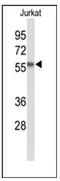 SAC1 Like Phosphatidylinositide Phosphatase antibody, AP53789PU-N, Origene, Western Blot image 