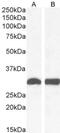 NAD(P)H Quinone Dehydrogenase 1 antibody, NB100-1005, Novus Biologicals, Western Blot image 