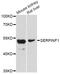 Serpin Family F Member 1 antibody, LS-C747131, Lifespan Biosciences, Western Blot image 
