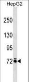 Monooxygenase DBH Like 1 antibody, LS-C158288, Lifespan Biosciences, Western Blot image 