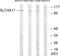 SLC4A11 antibody, GTX87741, GeneTex, Western Blot image 