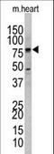 UV Radiation Resistance Associated antibody, LS-C160493, Lifespan Biosciences, Western Blot image 