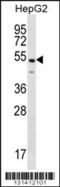 NFKB Activating Protein antibody, 56-401, ProSci, Western Blot image 