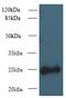 C-Type Lectin Domain Family 4 Member E antibody, A58586-100, Epigentek, Western Blot image 