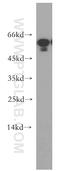 Tubulointerstitial Nephritis Antigen antibody, 19747-1-AP, Proteintech Group, Western Blot image 