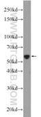 Glutamic--Pyruvic Transaminase 2 antibody, 16757-1-AP, Proteintech Group, Western Blot image 